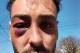 Violencia institucional en La Pampa: lutier platense denunció una brutal golpiza policial tras una discusión en la terminal