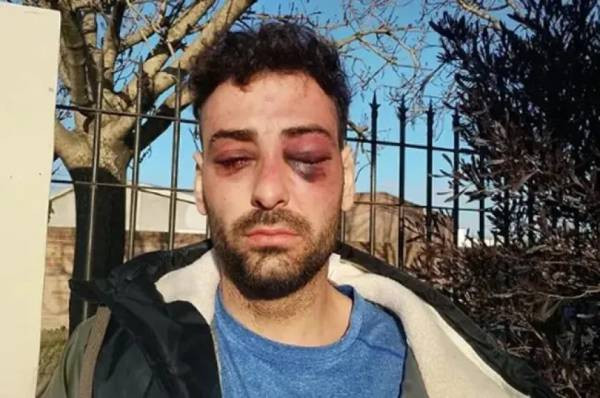 Audiencia clave: fijan fecha para formalizar a los siete policías acusados de la feroz golpiza al músico Lautaro Ruiz