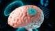La empresa de Elon Musk, Neuralink, instaló un implante cerebral en su primer paciente humano