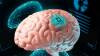 La empresa de Elon Musk, Neuralink, instaló un implante cerebral en su primer paciente humano