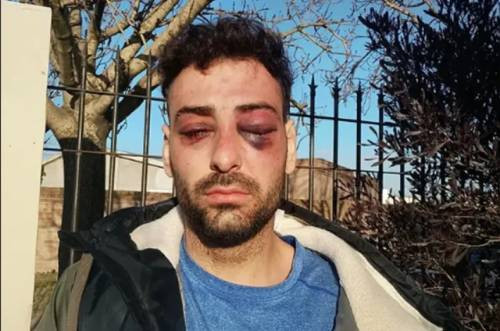 Apartan a siete policías tras la violenta golpiza a un lutier platense en Santa Rosa